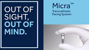 Micra® Transcatheter Pacing System (TPS)