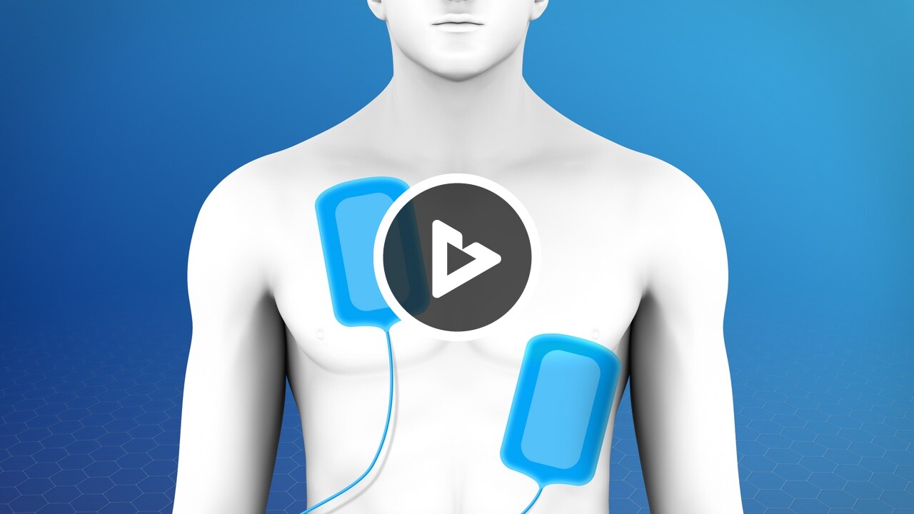 Cardioversion (Electrical) - Health Resources - Willis Knighton Health ...