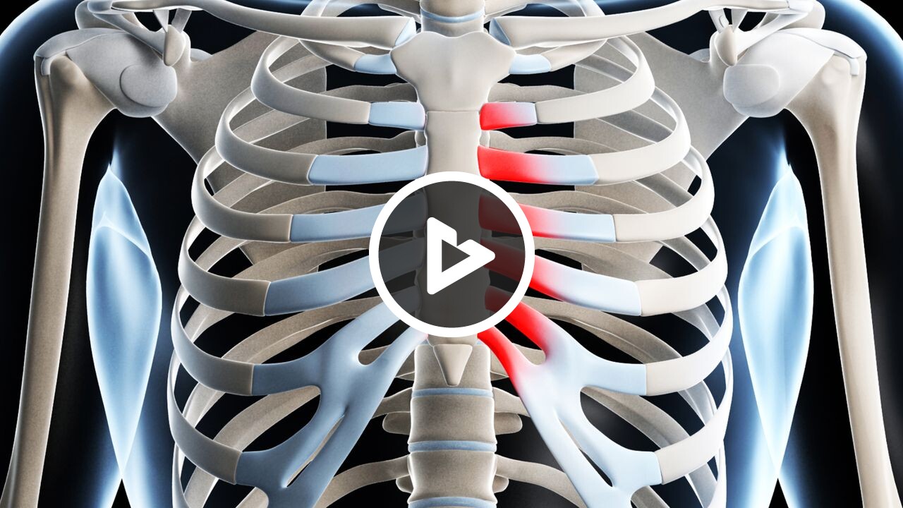Costochondritis - Disease & Condition Information - Willis Knighton Health  - Top Hospitals and Doctors in Shreveport