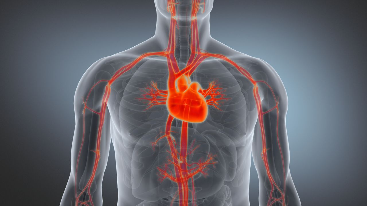 arterialinsufficiency