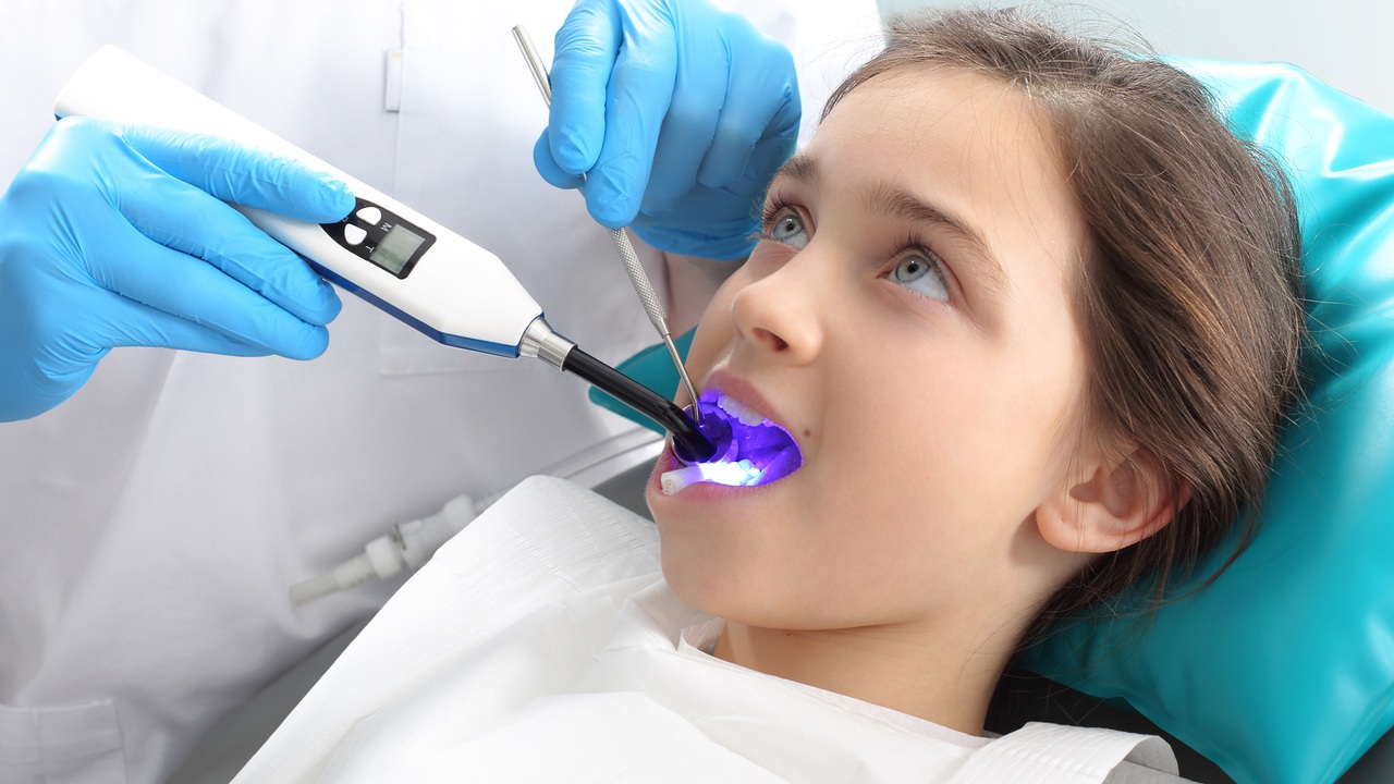 sealants