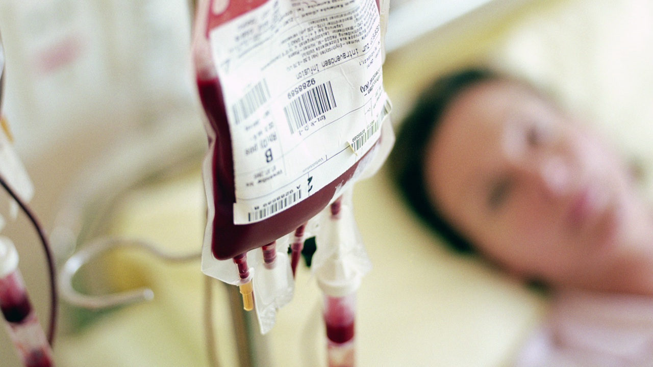 Peripheral Stem Cell Transplantation