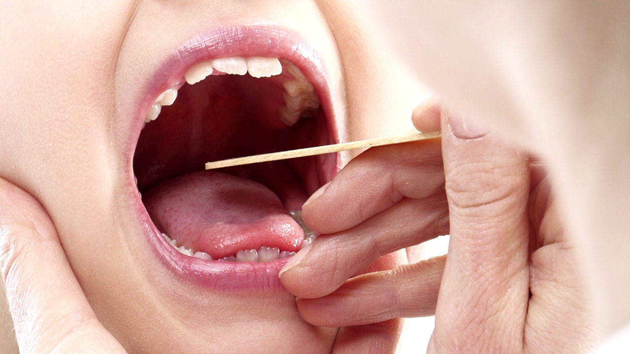 strepthroat_1280