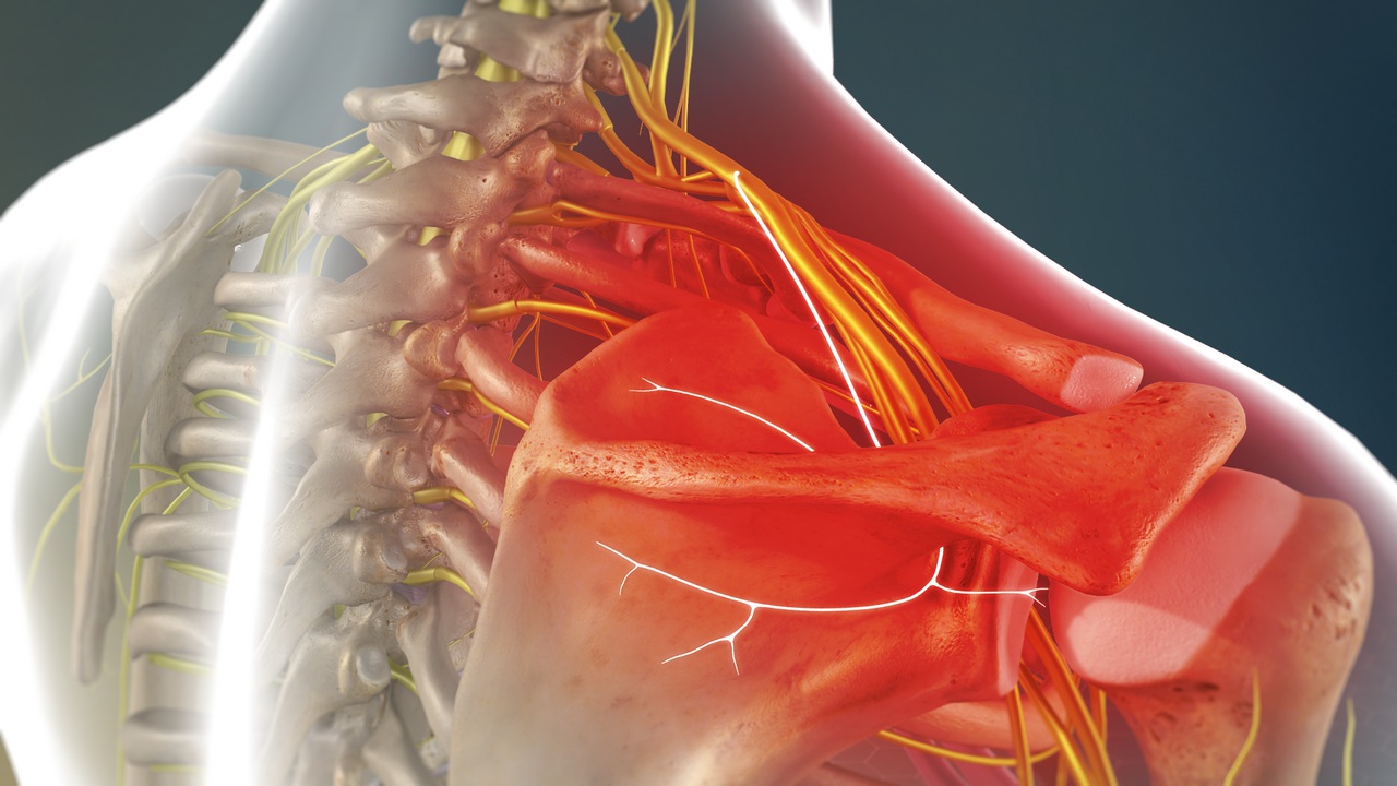 suprascapularneuropathy